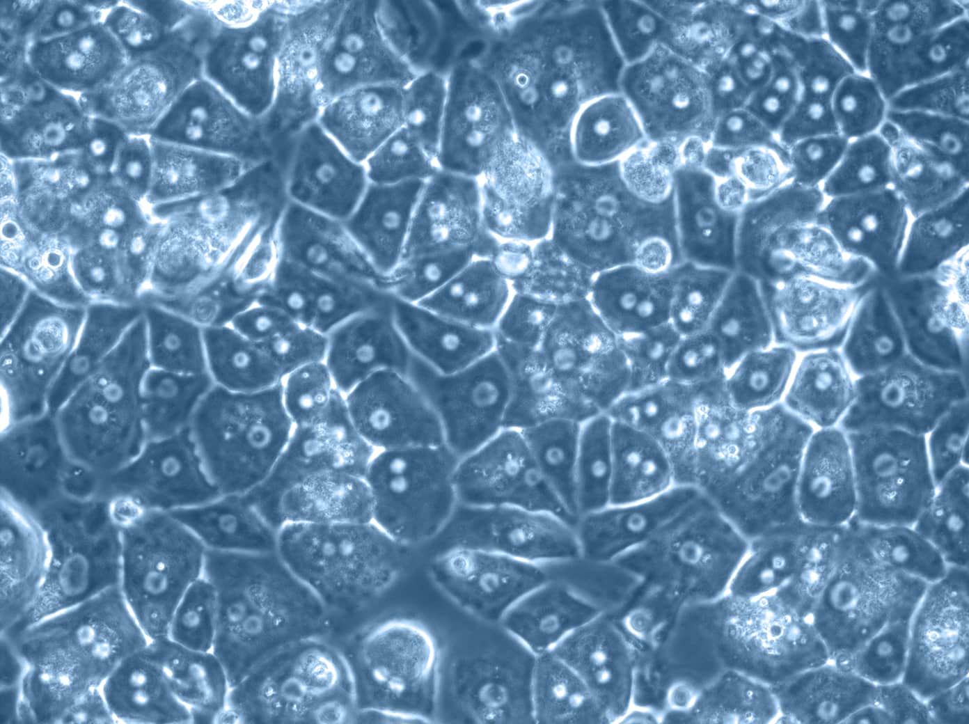 VitaCyte to Exhibit at the 9th EPITA Symposium/38th AIDPIT Workshop